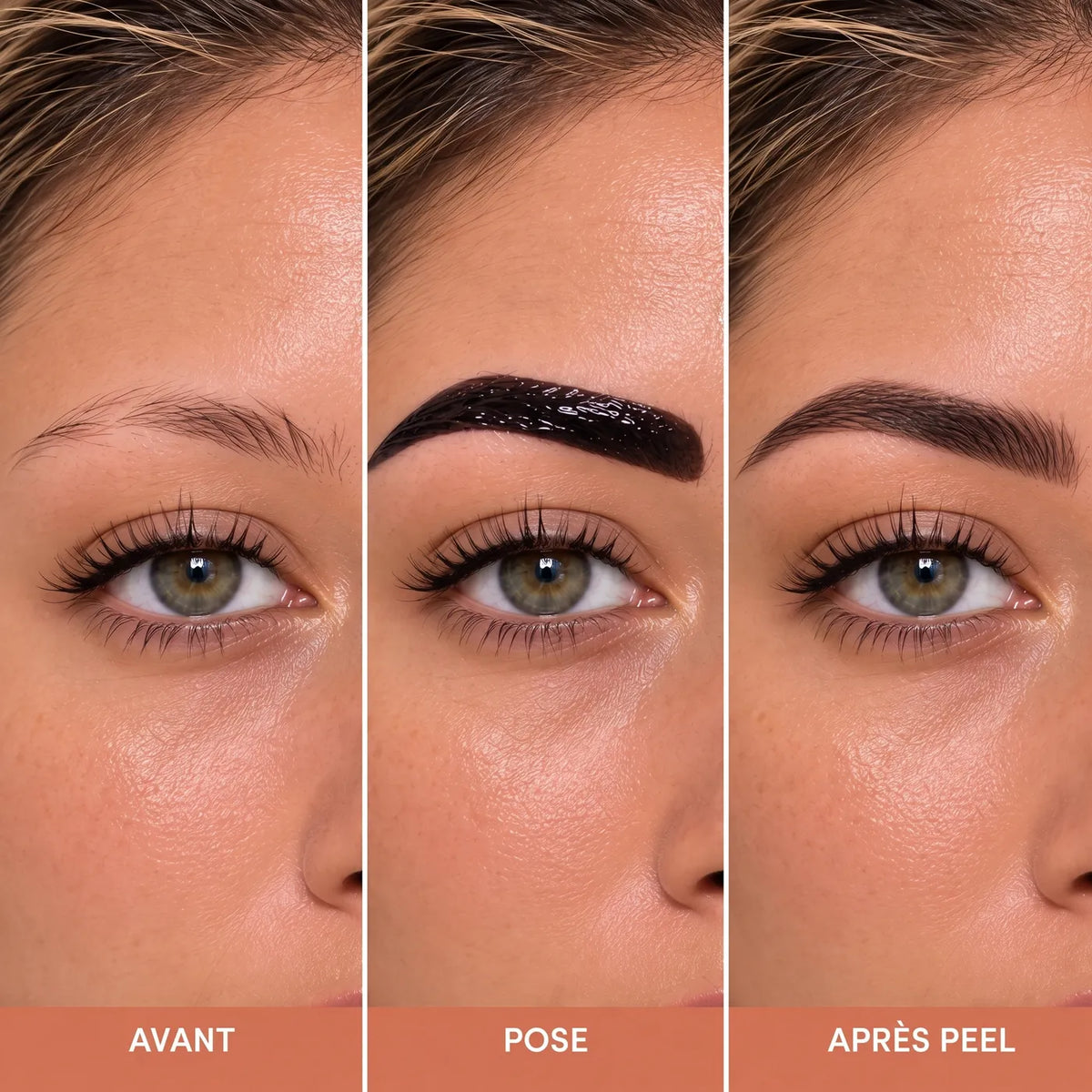 Avant, pose, après peel