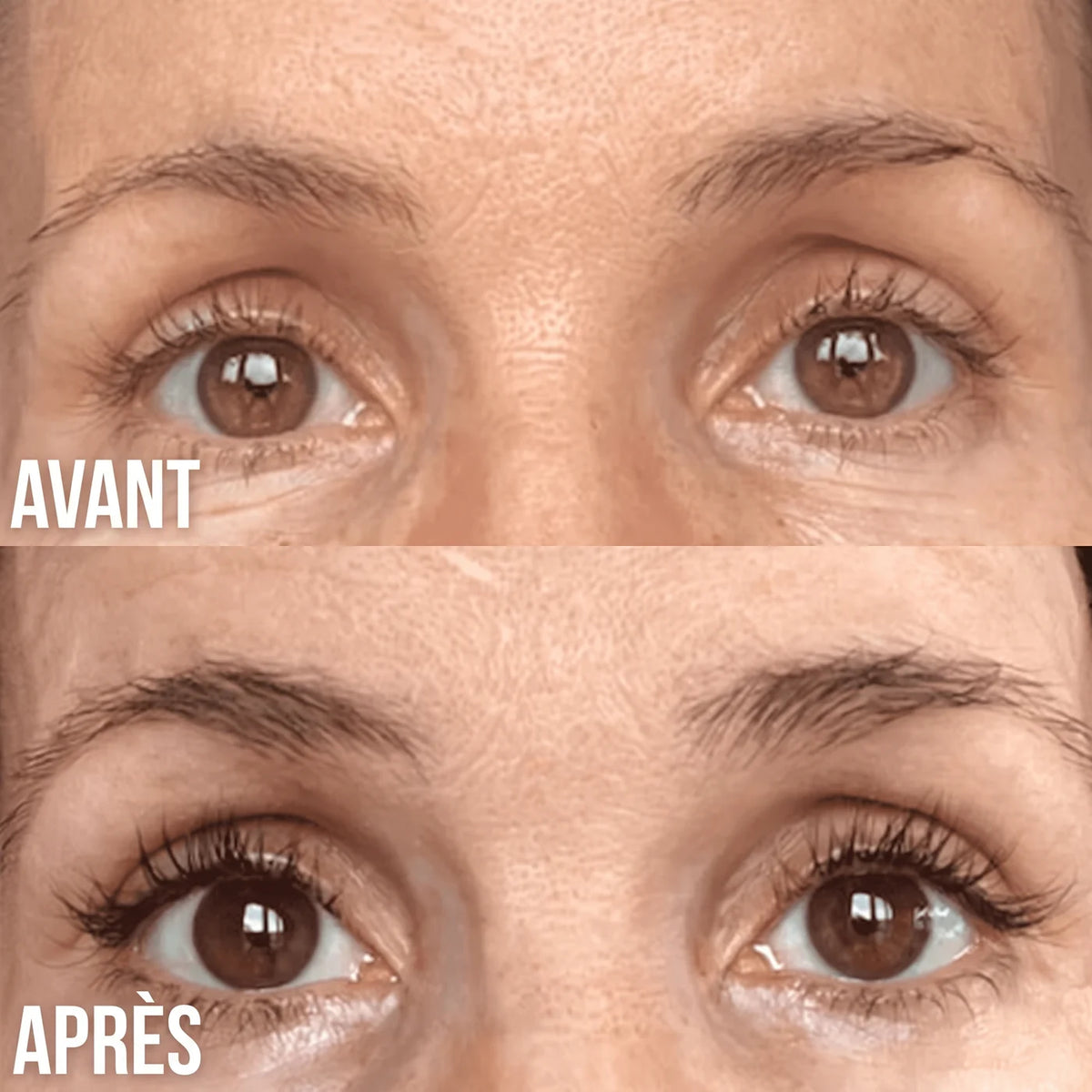 Avant / après