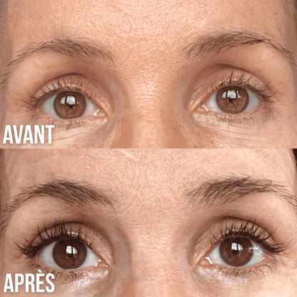 Avant / après