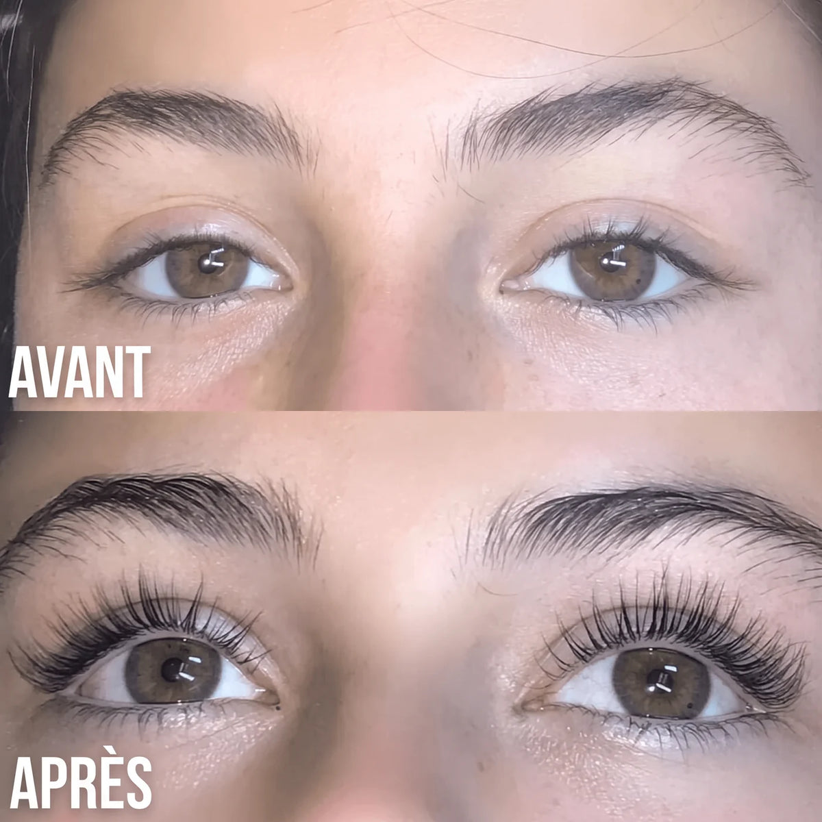 Avant / après
