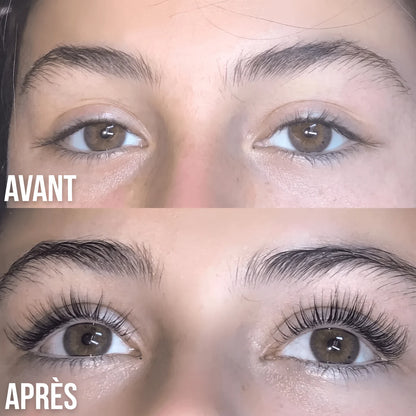 Avant / après
