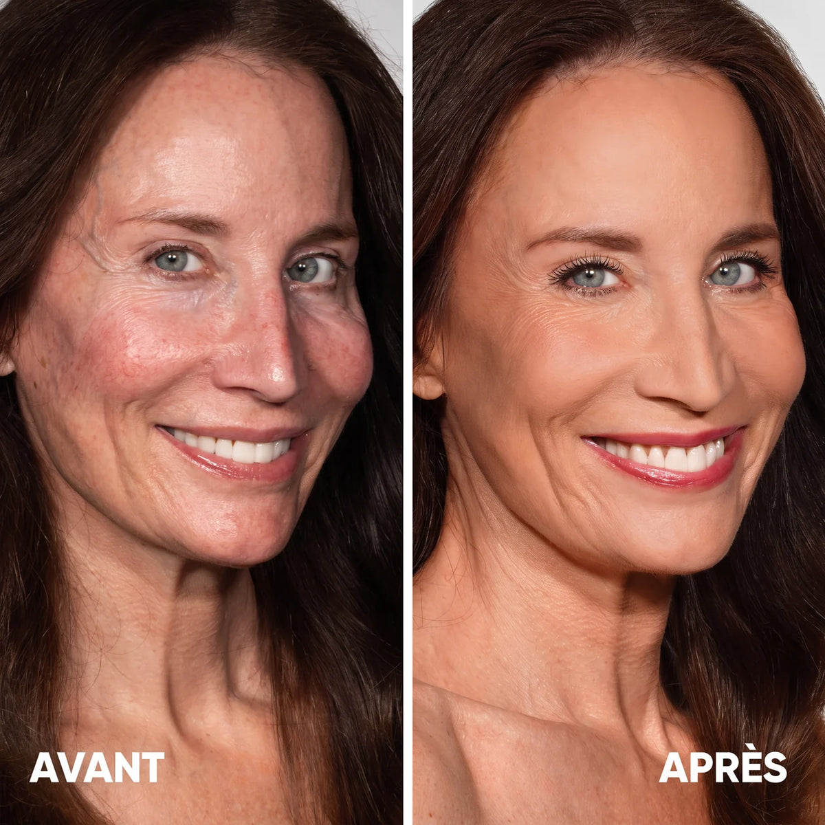 Avant / après
