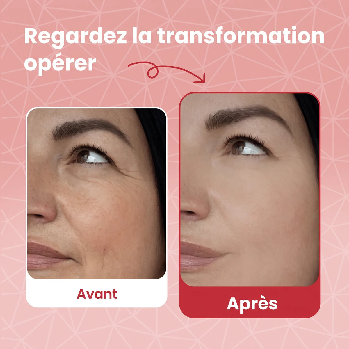 Avant / après